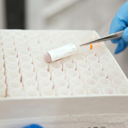 close up of tissue vials in a freezer box